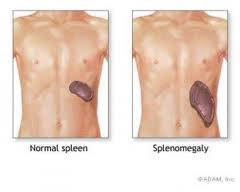 Big Spleen, Little Spleen... wait, where's my cardboard box!