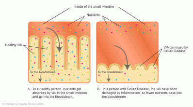 Comparison of Intestinal lining